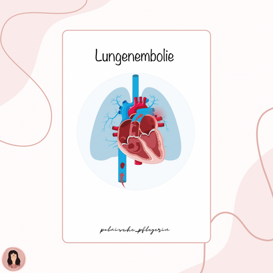 Digitaler Lernzettel - Lungenembolie