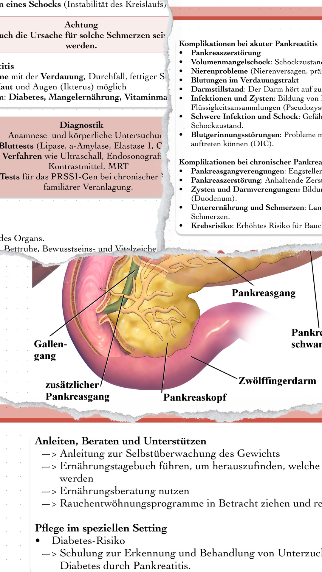 Digitaler Lernzettel - Pankreatitis