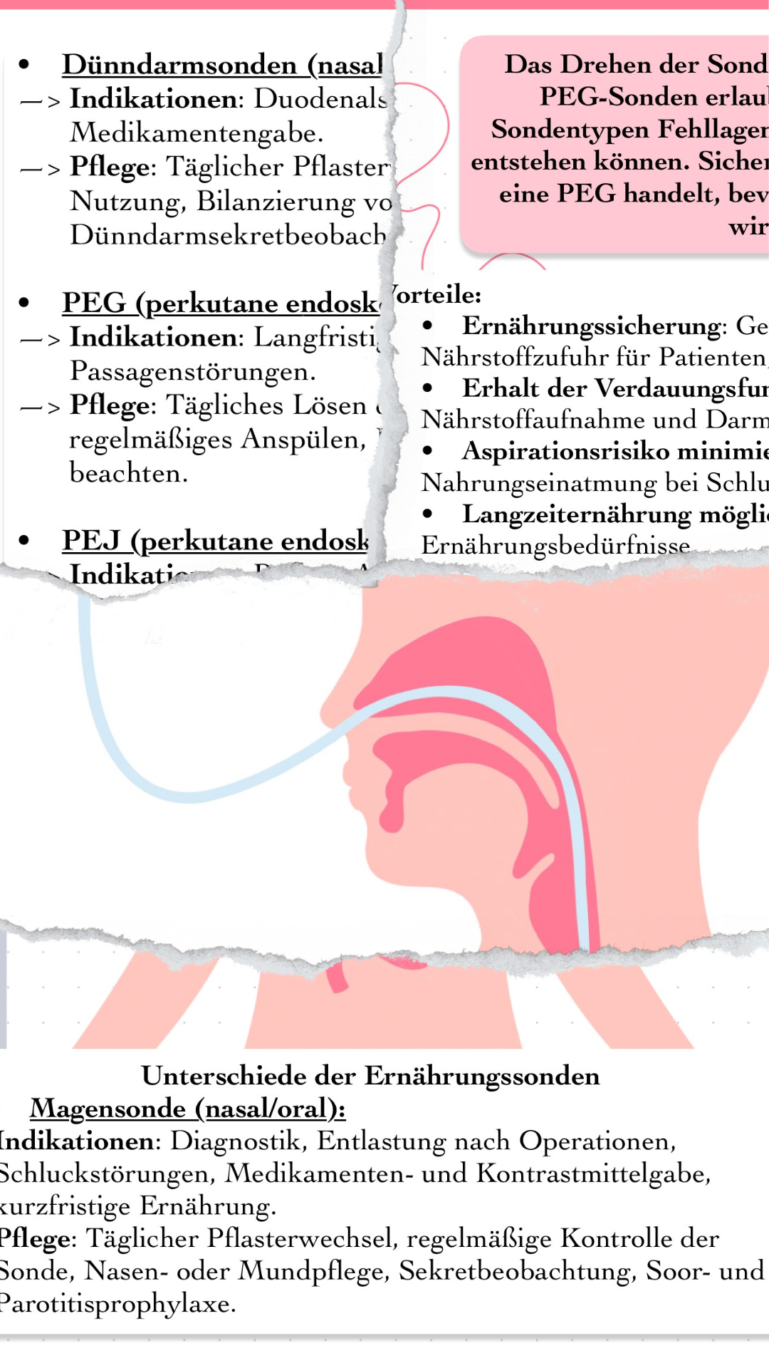 Digitaler Lernzettel - Ernährungssonden