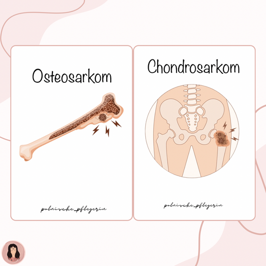 Digitaler Lernzettel - Chondrosarkom und Osteosarkom (Knochentumor)