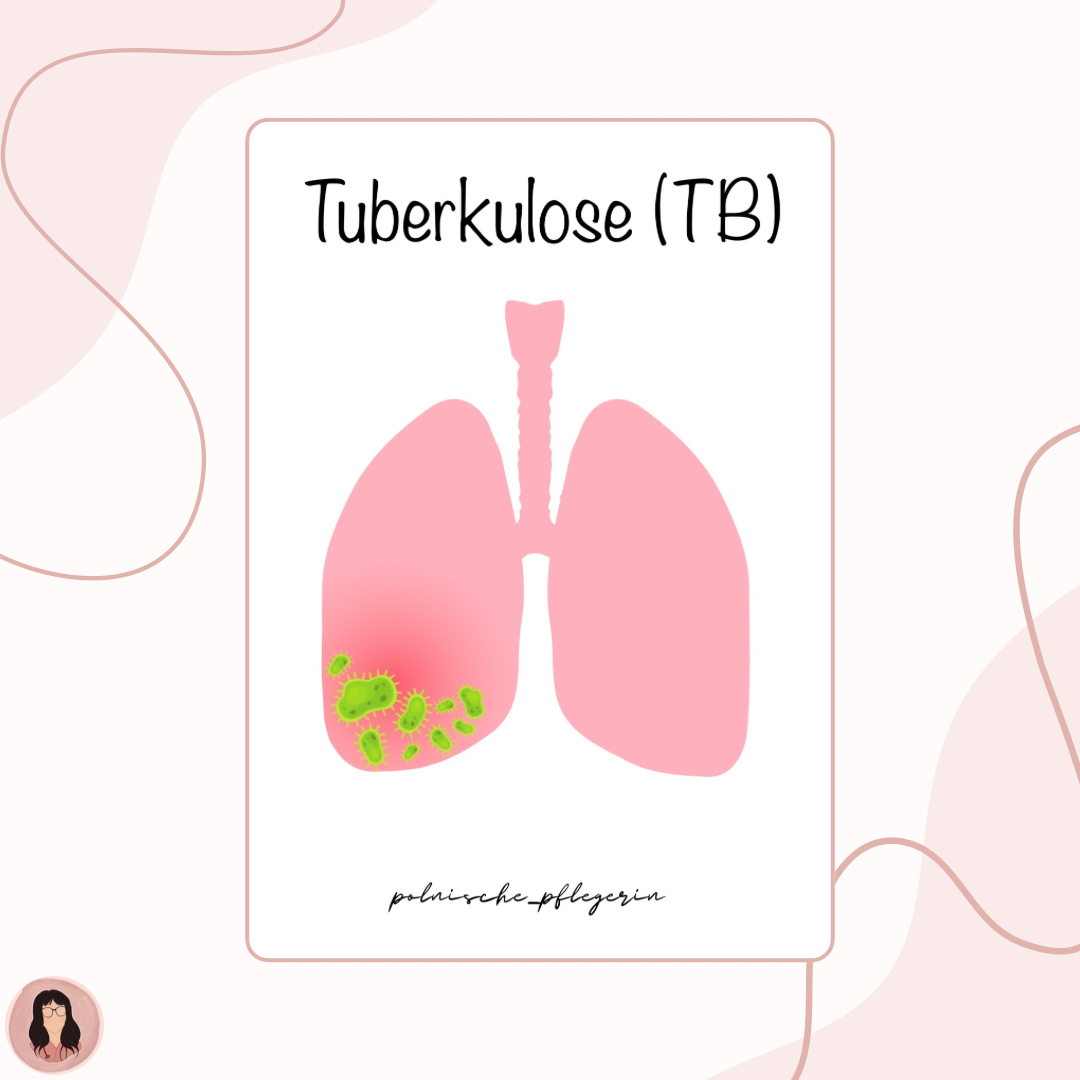 Digitaler Lernzettel - Tuberkulose (TB)