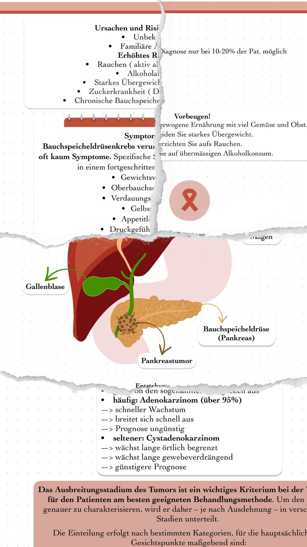 Digitaler Lernzettel - Pankreaskarzinom (Bauchspeicheldrüsenkrebs)