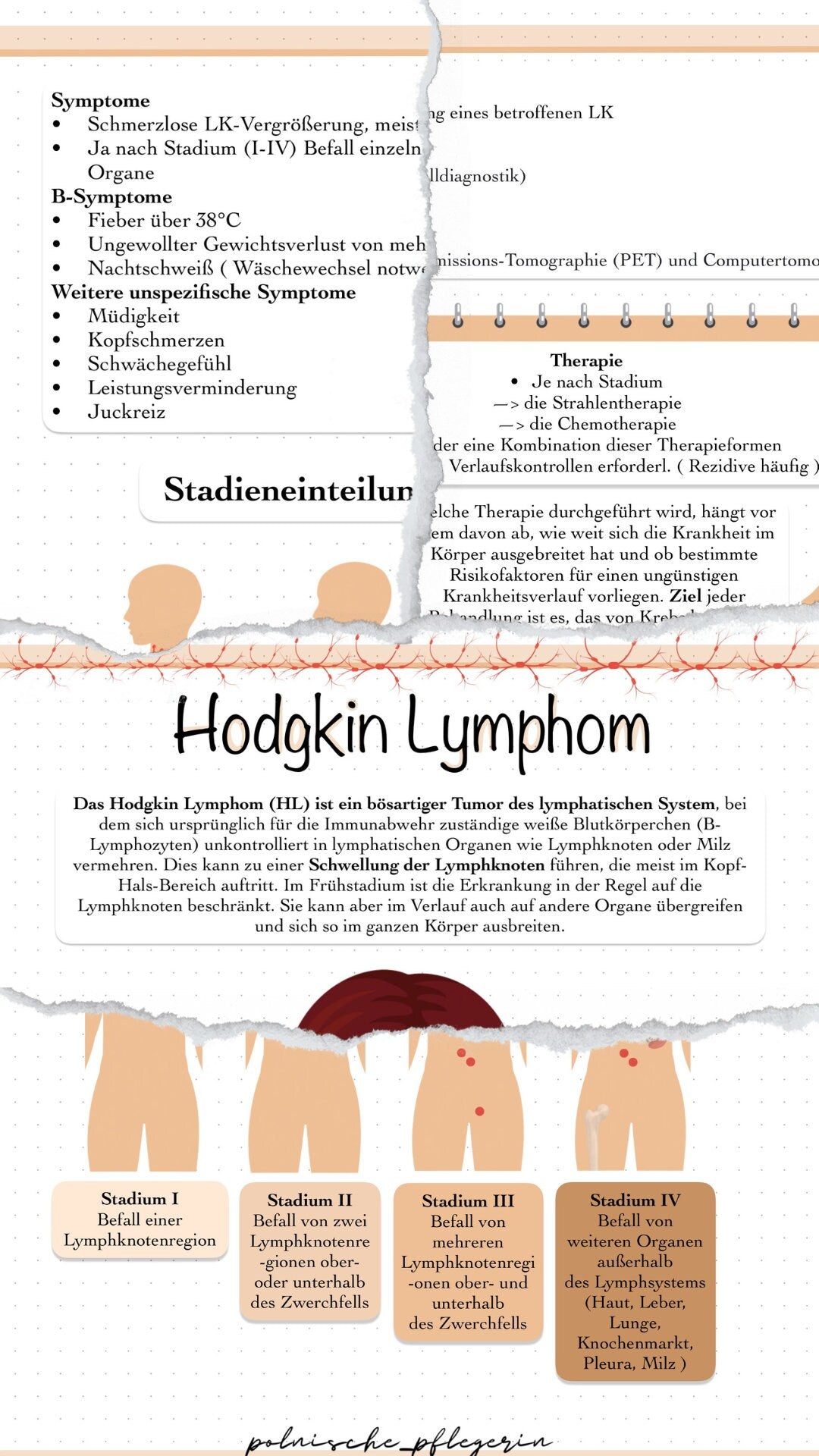 Digitaler Lernzettel - Hodgkin Lymphom (Lymphdrüsenkrebs)