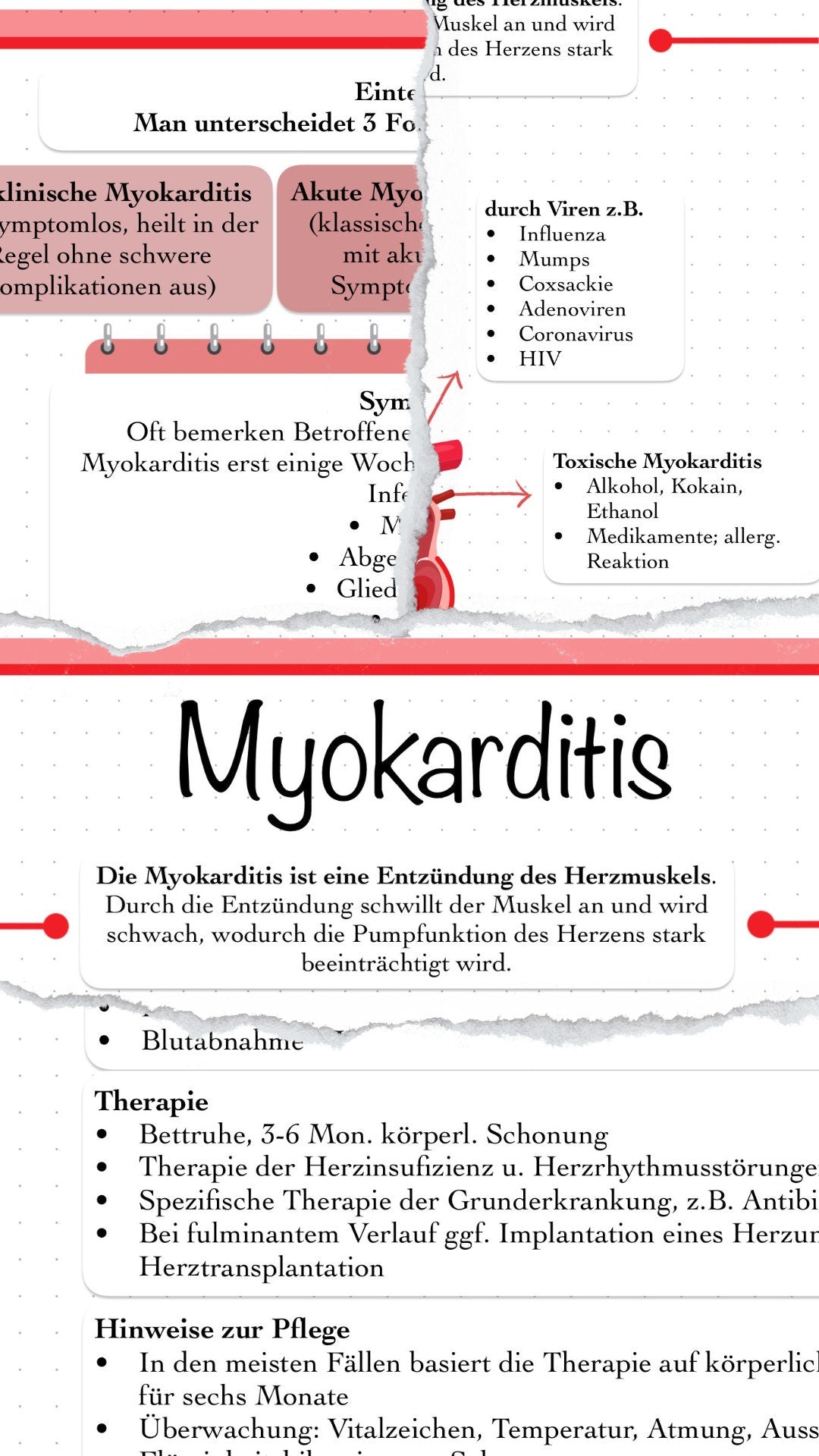 Digitaler Lernzettel - Myokarditis