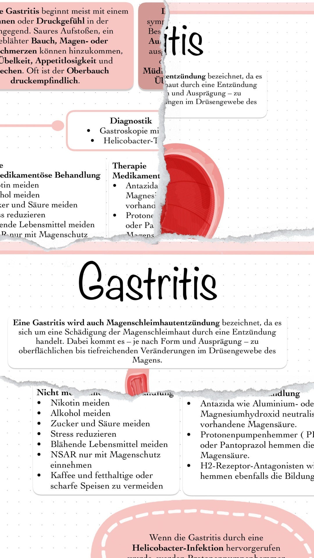 Digitaler Lernzettel - Gastritis