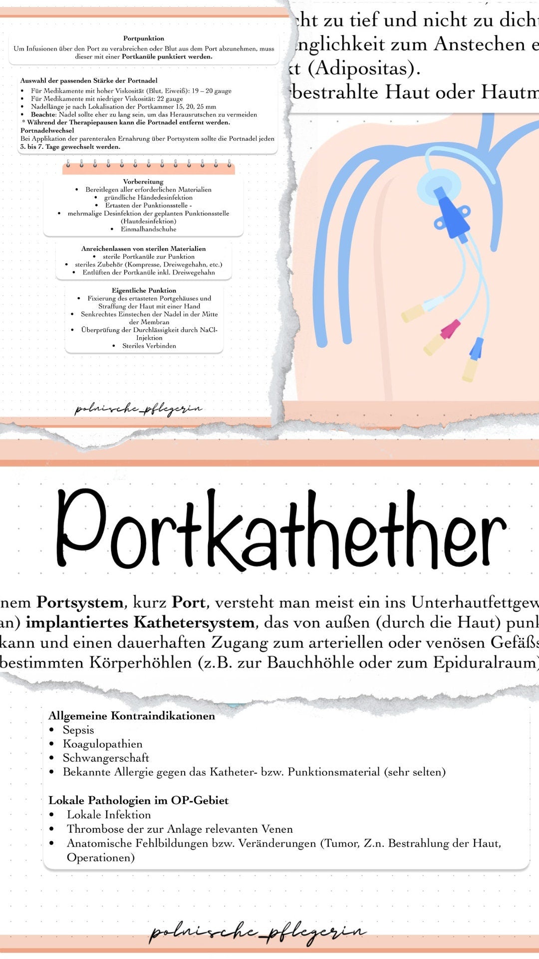 Digitaler Lernzettel - Portkathether