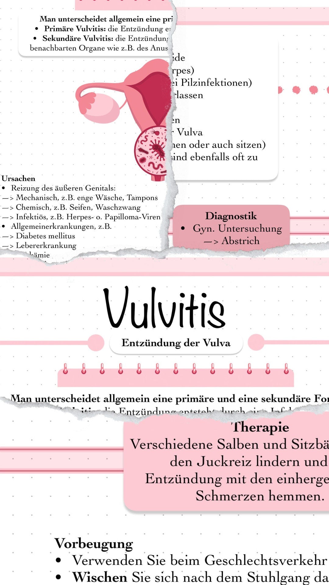 Digitaler Lernzettel - Vulvitis