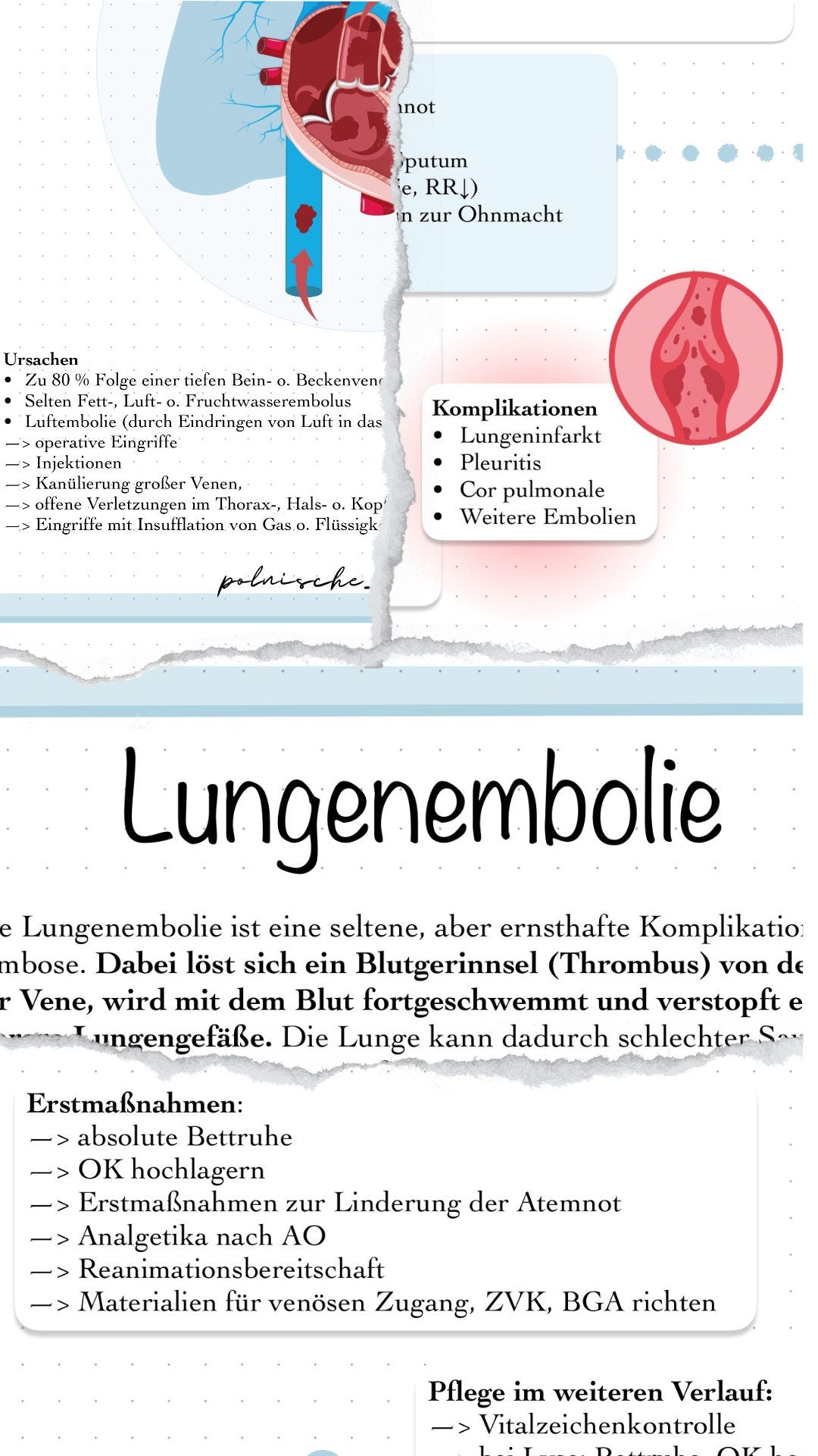 Digitaler Lernzettel - Lungenembolie