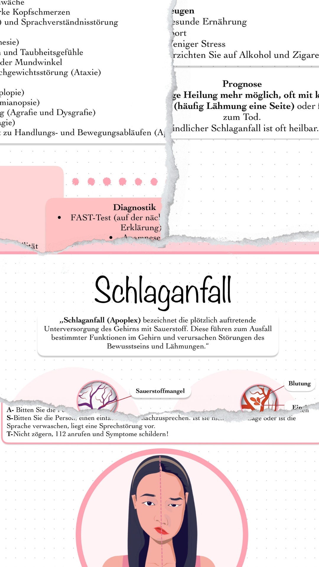 Digitaler Lernzettel - Schlaganfall