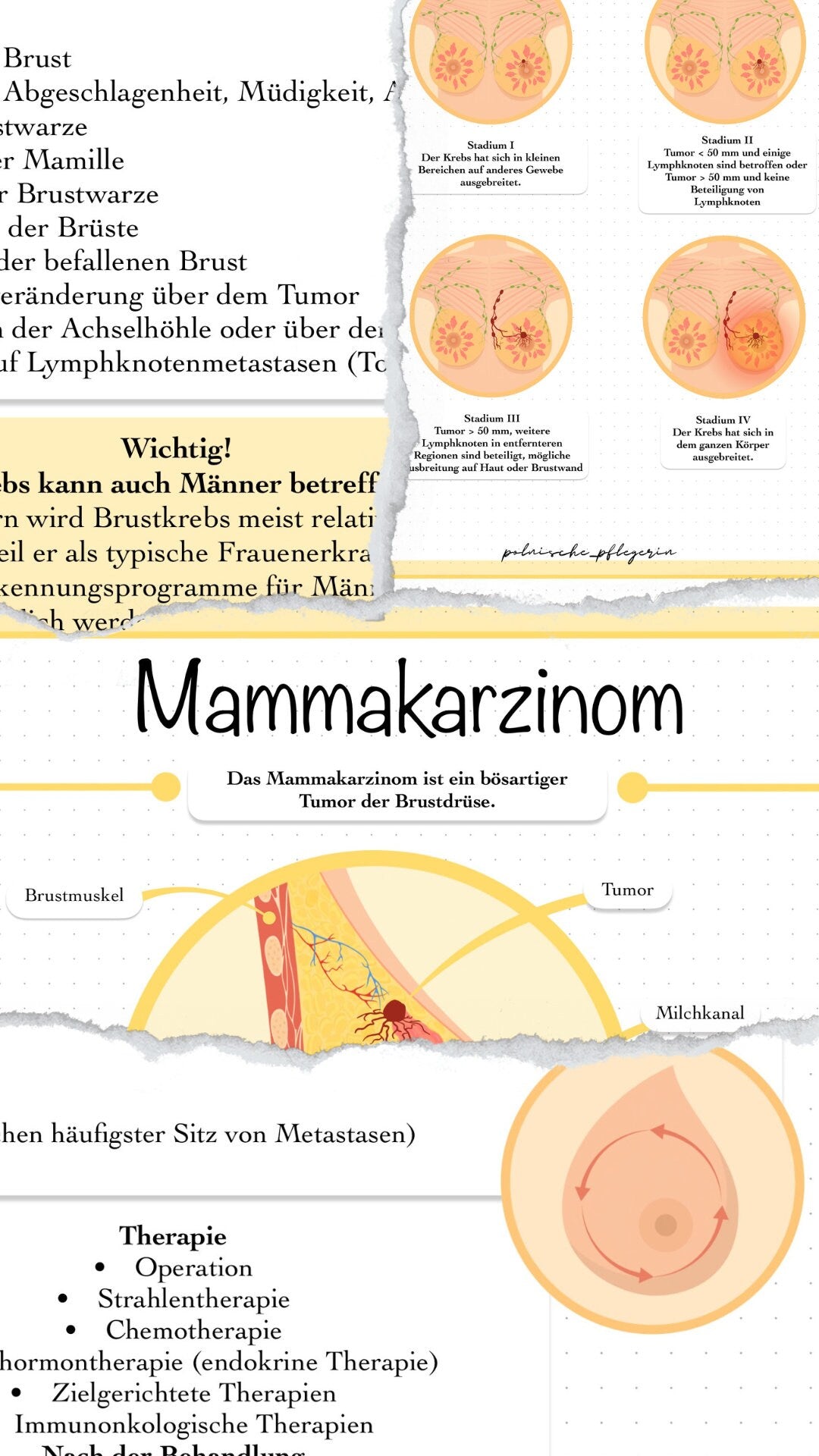 Digitaler Lernzettel - Brustkrebs