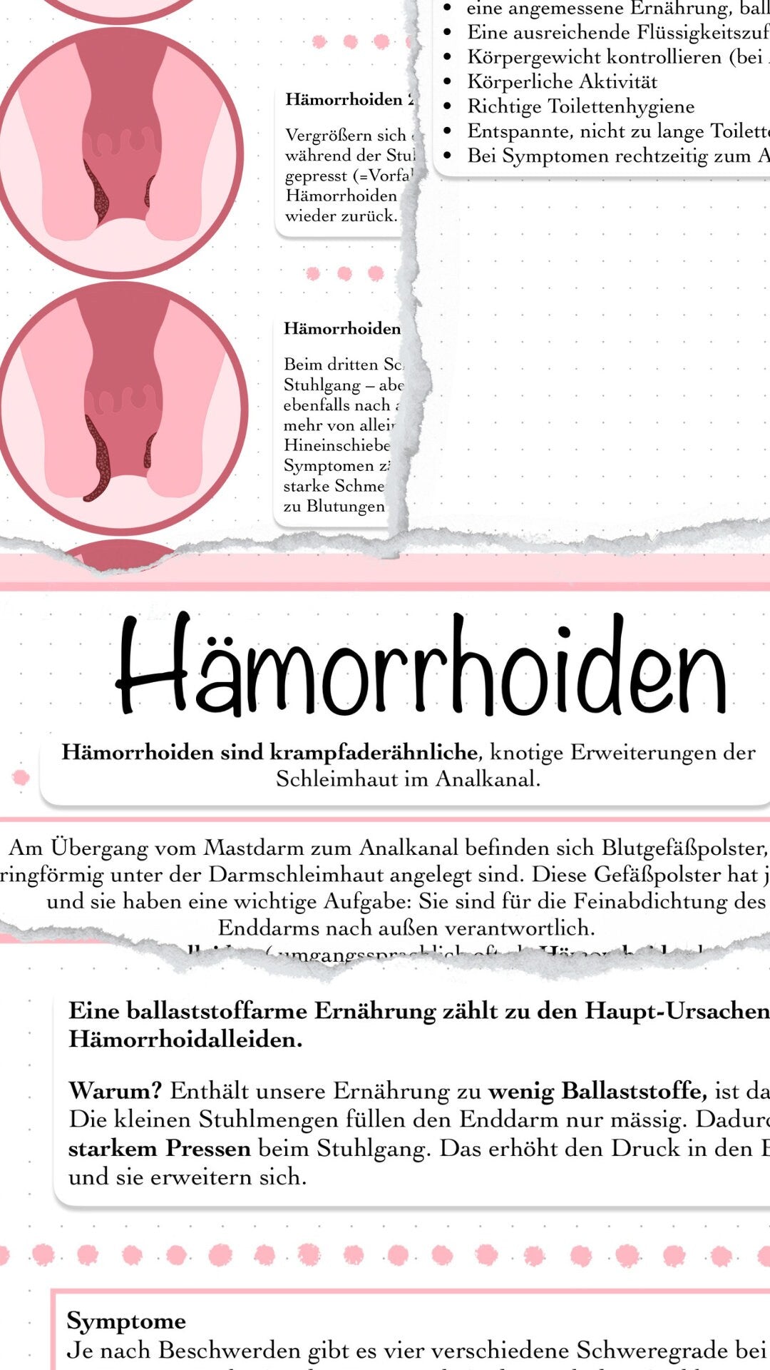 Digitaler Lernzettel - Hämorrhoiden