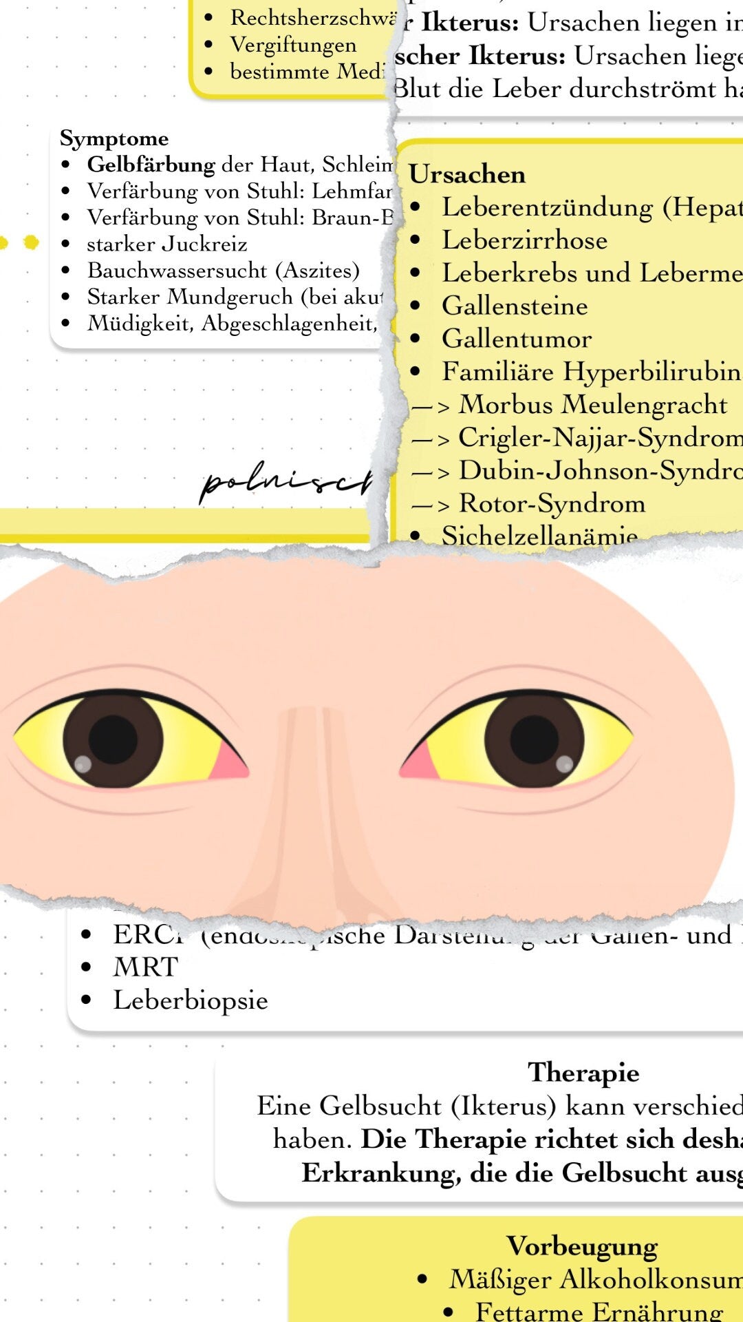 Digitaler Lernzettel - Ikterus