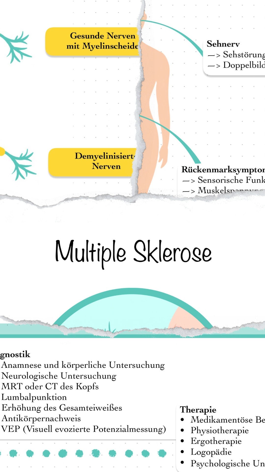 Digitaler Lernzettel - Multiple Sklerose