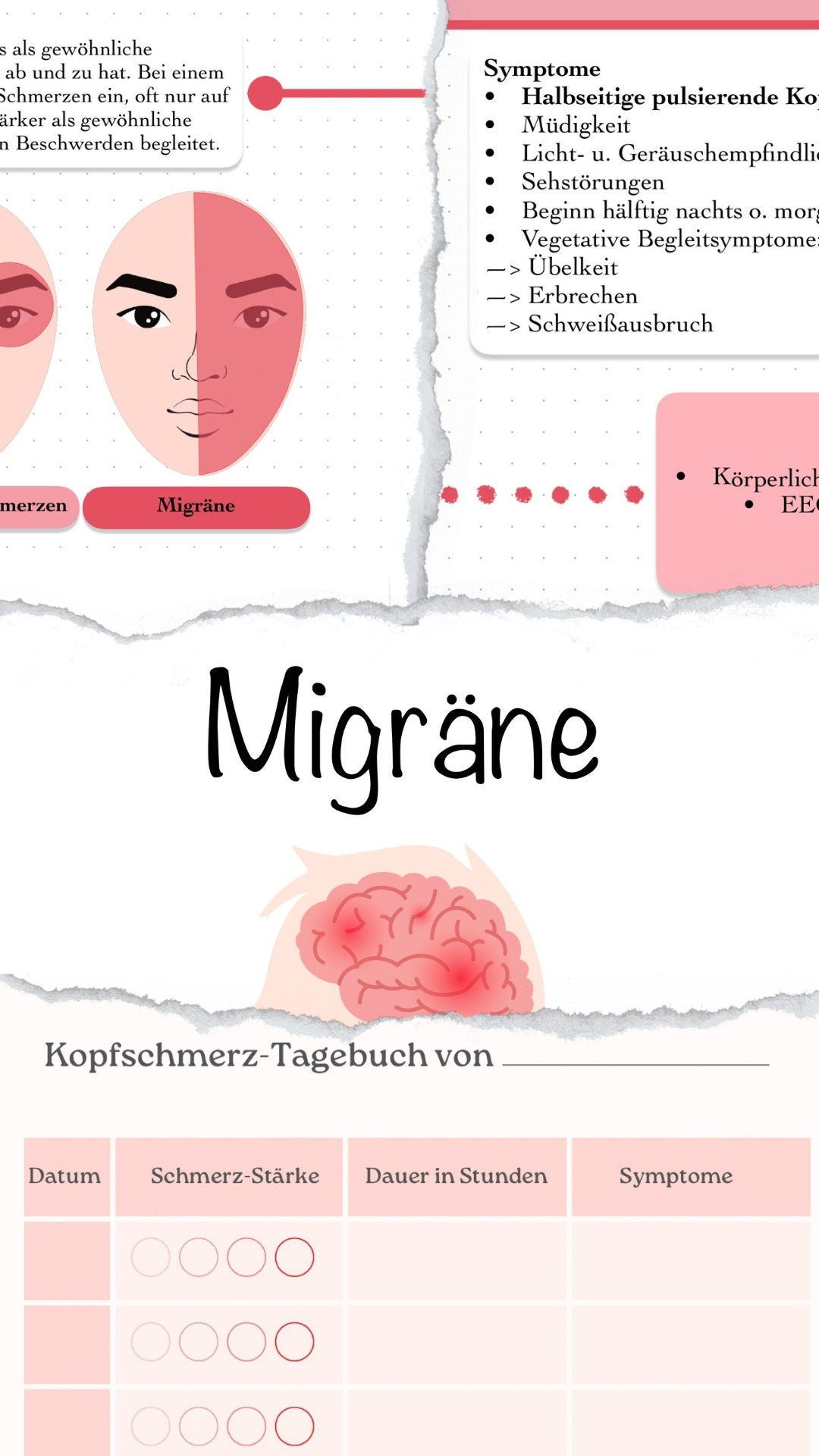 Digitaler Lernzettel - Migräne